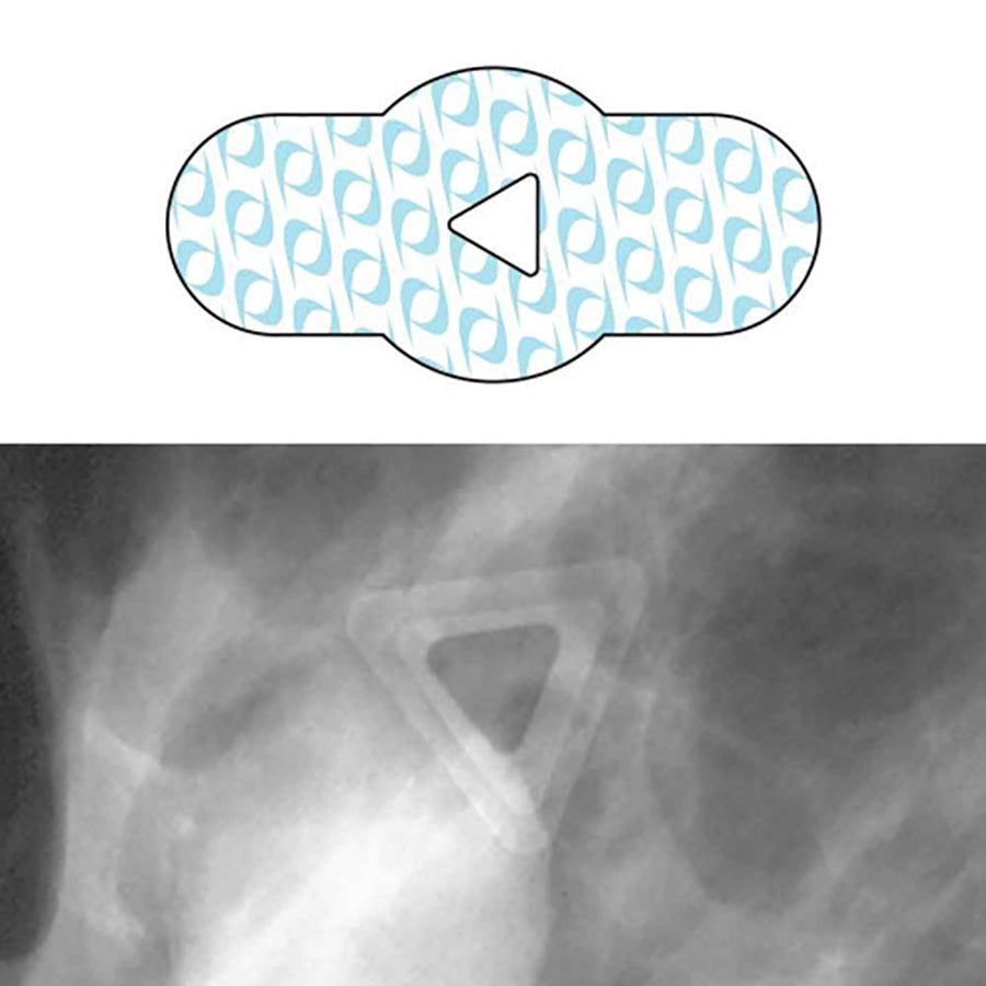 <ul class="product-features"><li>For palpable nodules, signaling the radiologist of the irregularity without obscuring area of concern on film</li><li>Our radiolucent skin markers will not burnout</li><li>Offers dual density views</li></ul>
