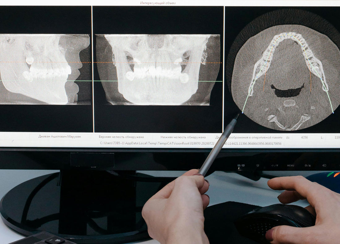 How Spectrum X-Ray Drives the Future of Medical Imaging Technology