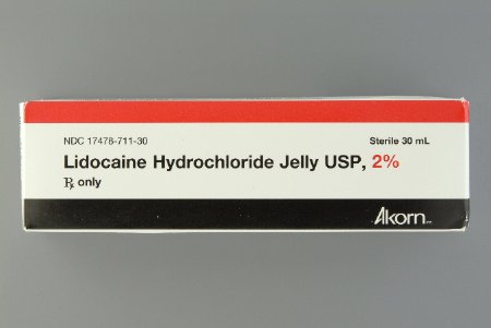 Features<li>Lidocaine Hydrochloride Injection, USP is indicated for production of local or regional anesthesia by infiltration techniques such as percutaneous injection and intravenous regional anesthesia by peripheral nerve block techniques such as brachial plexus and intercostal and by central neural techniques such as lumbar and caudal epidural blocks.</li>