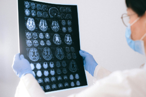 Top 5 Medical Imaging Trends to Watch in 2024: Insights From Spectrum X-Ray