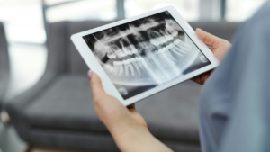 Vieworks DR panels Los Angeles