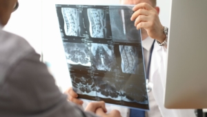 Digital radiography panels